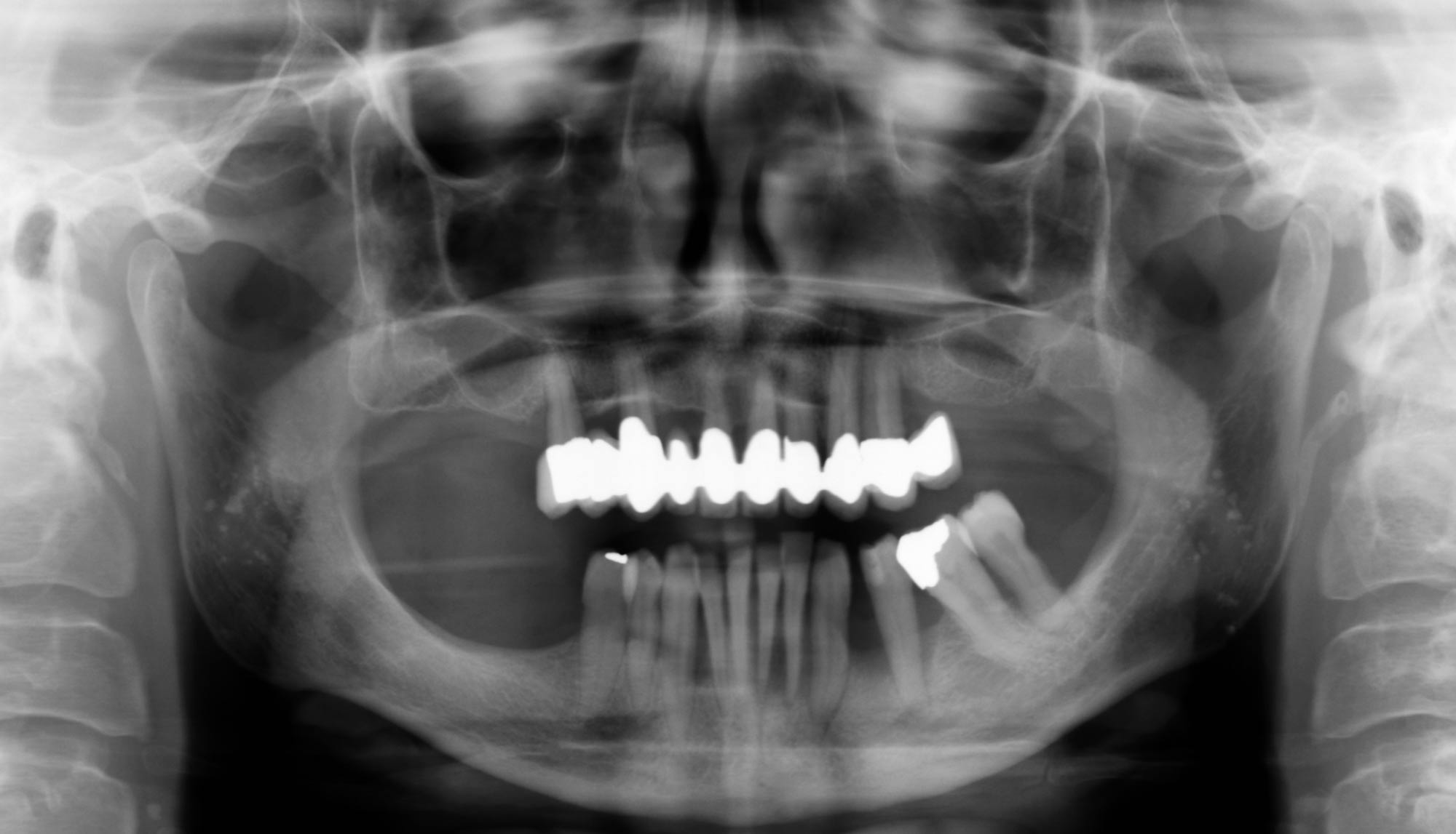 radiografia denti Parodontologia